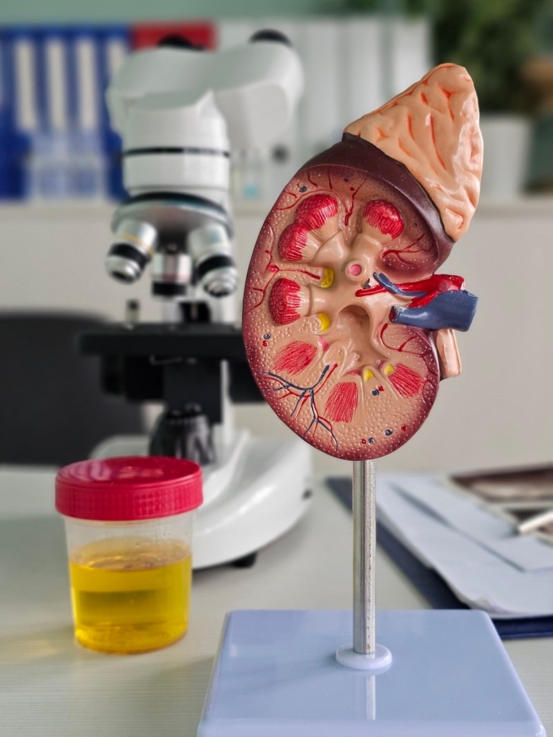 nefrologo-para-enfermedad-renal-en-toluca-de-lerdo-mexico